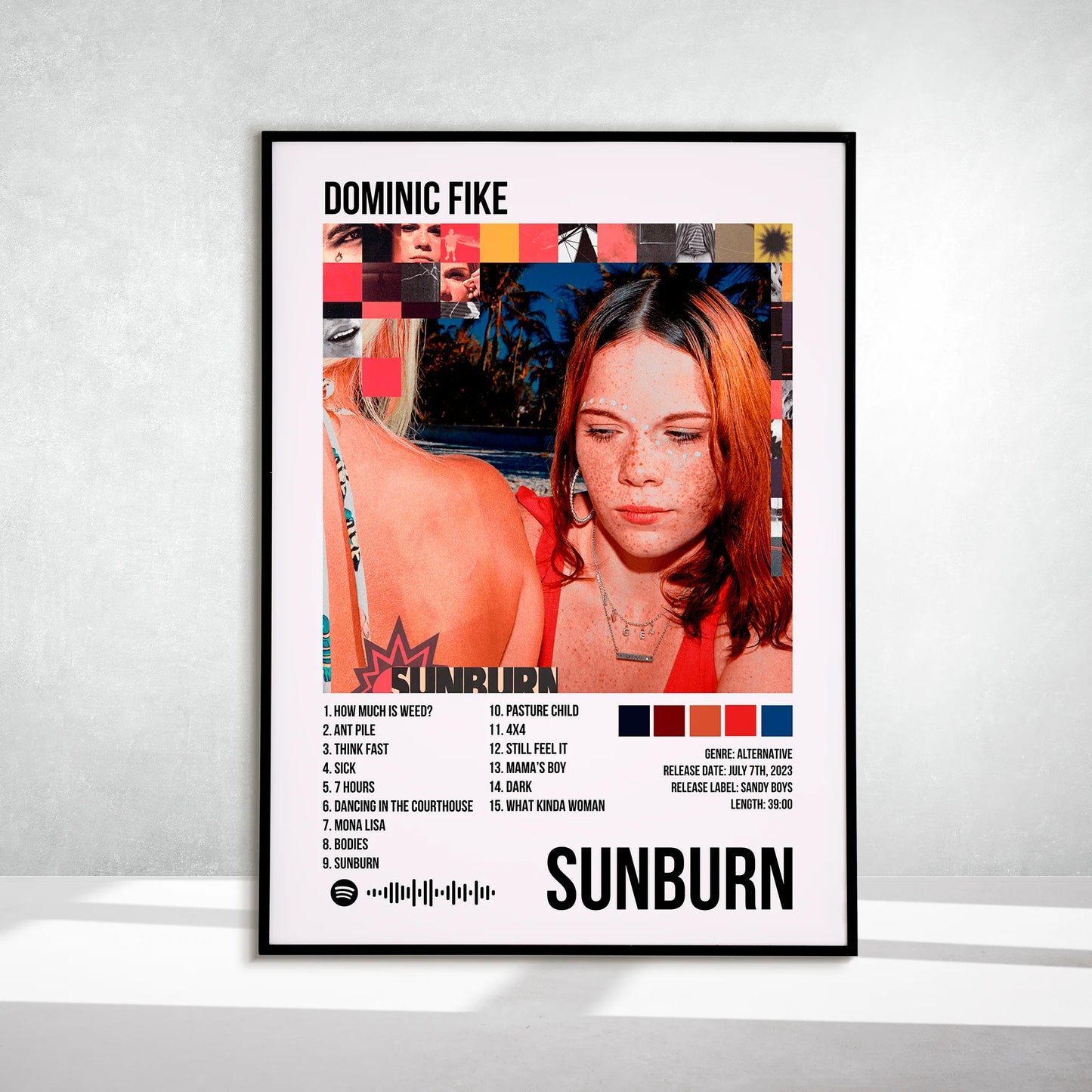 Sunburn