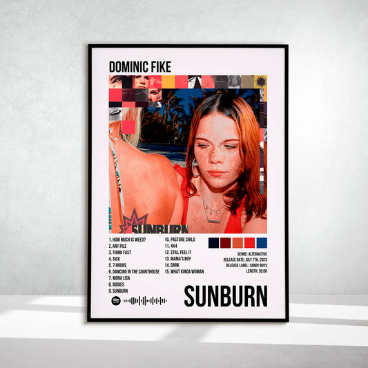 Sunburn